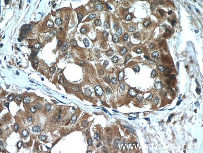 Sodium Iodide Symporter Antibody in Immunohistochemistry (Paraffin) (IHC (P))