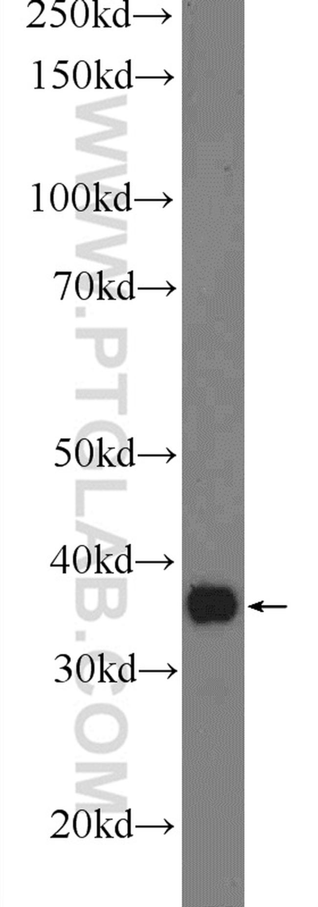 ACPT Antibody in Western Blot (WB)