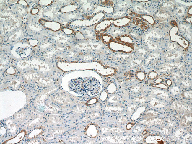 SGLT3/SLC5A4 Antibody in Immunohistochemistry (Paraffin) (IHC (P))