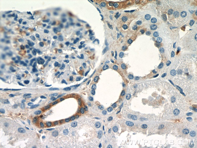 SGLT3/SLC5A4 Antibody in Immunohistochemistry (Paraffin) (IHC (P))