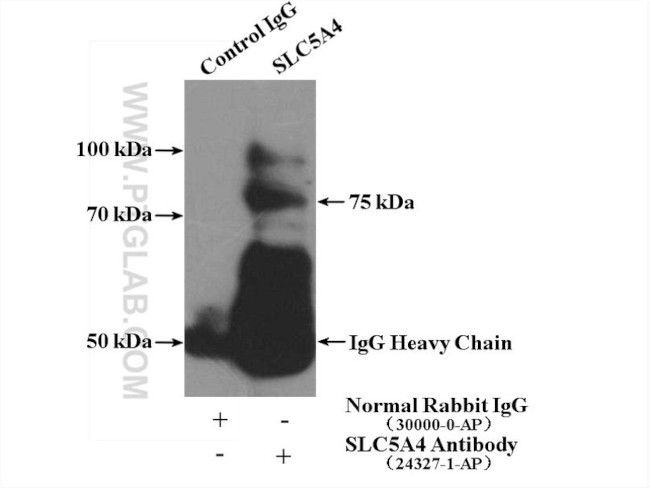 SGLT3/SLC5A4 Antibody in Immunoprecipitation (IP)
