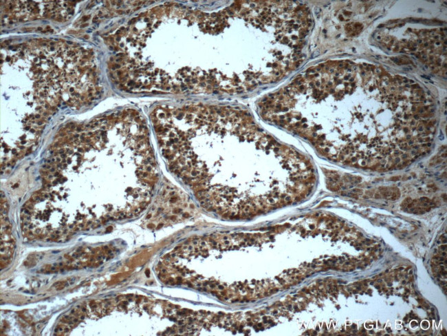 IFT43 Antibody in Immunohistochemistry (Paraffin) (IHC (P))