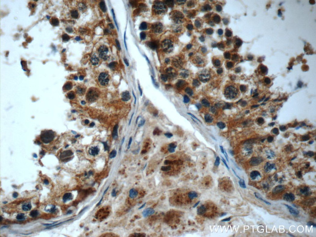 IFT43 Antibody in Immunohistochemistry (Paraffin) (IHC (P))