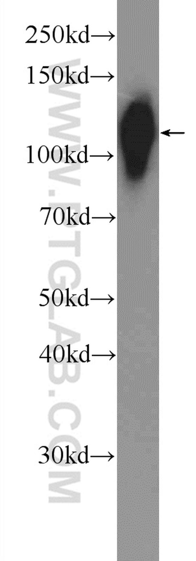 Cadherin-17 Antibody in Western Blot (WB)