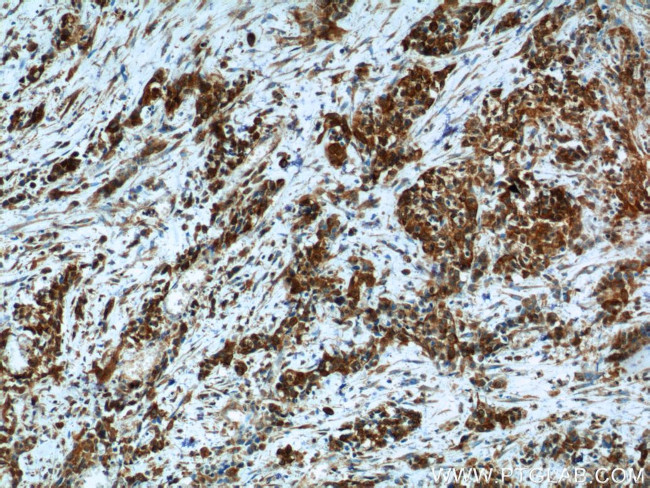 Cadherin-17 Antibody in Immunohistochemistry (Paraffin) (IHC (P))