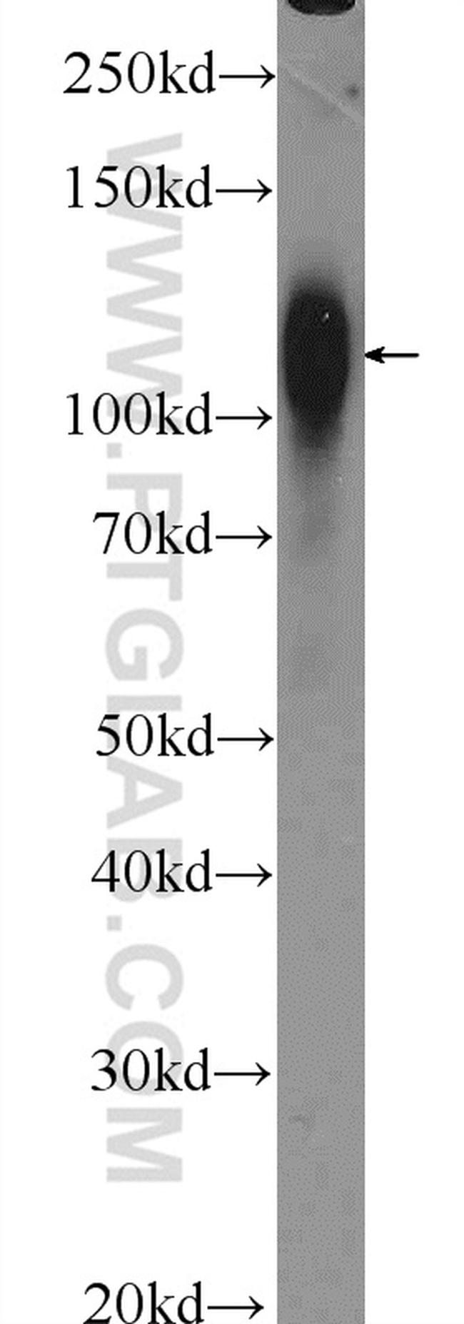 Cadherin-17 Antibody in Western Blot (WB)