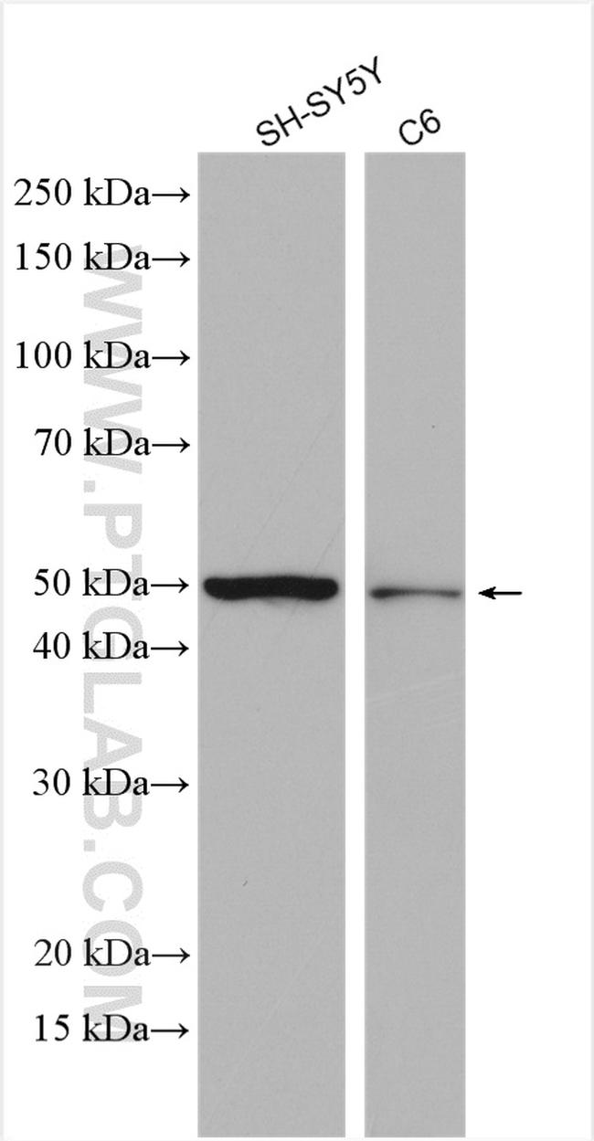 UGT2A1 Antibody in Western Blot (WB)