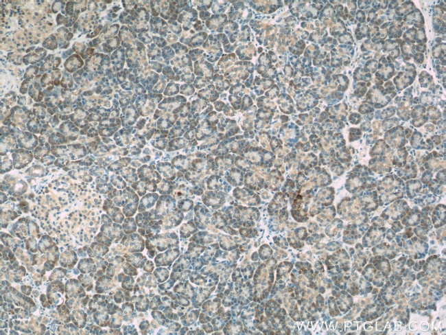 ERP29 Antibody in Immunohistochemistry (Paraffin) (IHC (P))