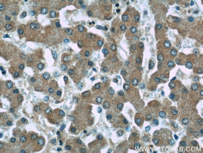 ERP29 Antibody in Immunohistochemistry (Paraffin) (IHC (P))