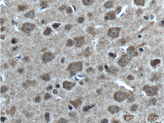 ABCA8 Antibody in Immunohistochemistry (Paraffin) (IHC (P))