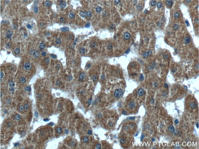 ABCA8 Antibody in Immunohistochemistry (Paraffin) (IHC (P))