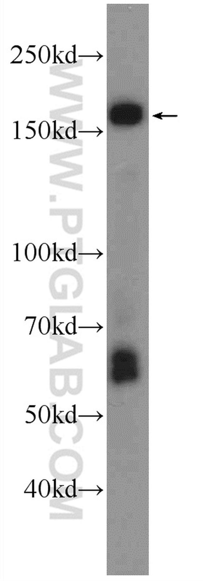 ABCA8 Antibody in Western Blot (WB)