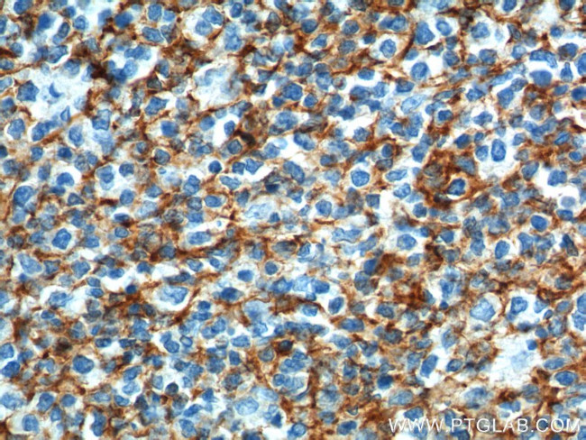 CD21 Antibody in Immunohistochemistry (Paraffin) (IHC (P))