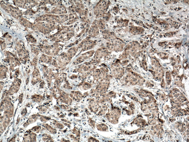 ACTN3 Antibody in Immunohistochemistry (Paraffin) (IHC (P))