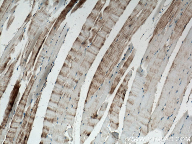 ACTN3 Antibody in Immunohistochemistry (Paraffin) (IHC (P))