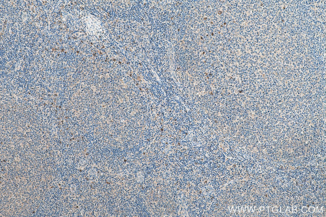 VSTM1 Antibody in Immunohistochemistry (Paraffin) (IHC (P))