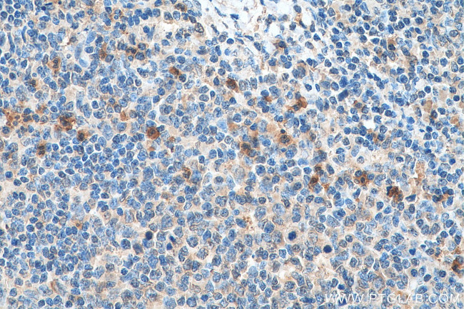 VSTM1 Antibody in Immunohistochemistry (Paraffin) (IHC (P))