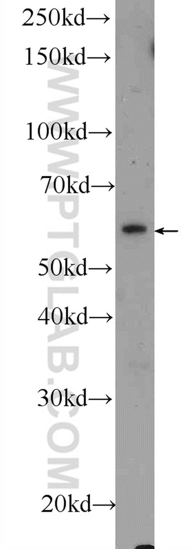 KIAA1598 Antibody in Western Blot (WB)