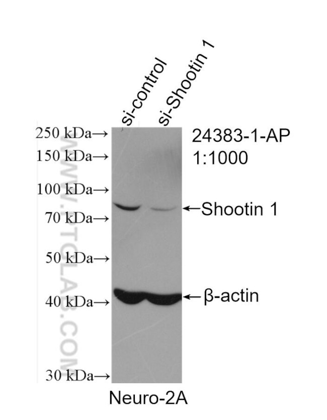 KIAA1598 Antibody in Western Blot (WB)