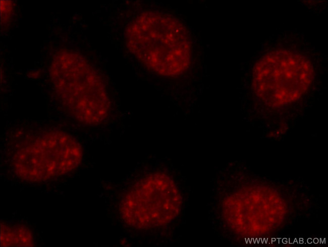 C17orf85 Antibody in Immunocytochemistry (ICC/IF)