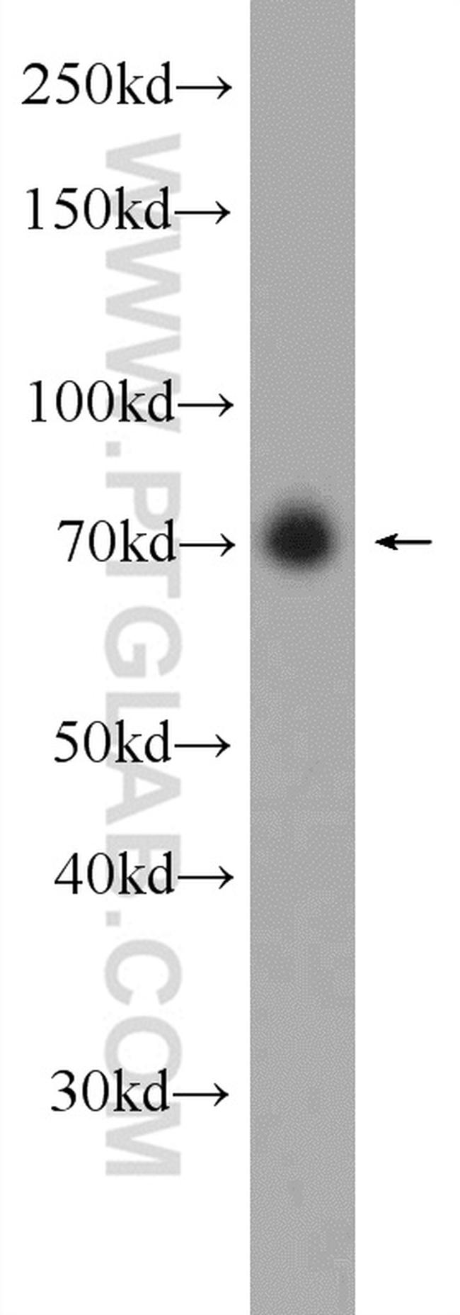 C17orf85 Antibody in Western Blot (WB)