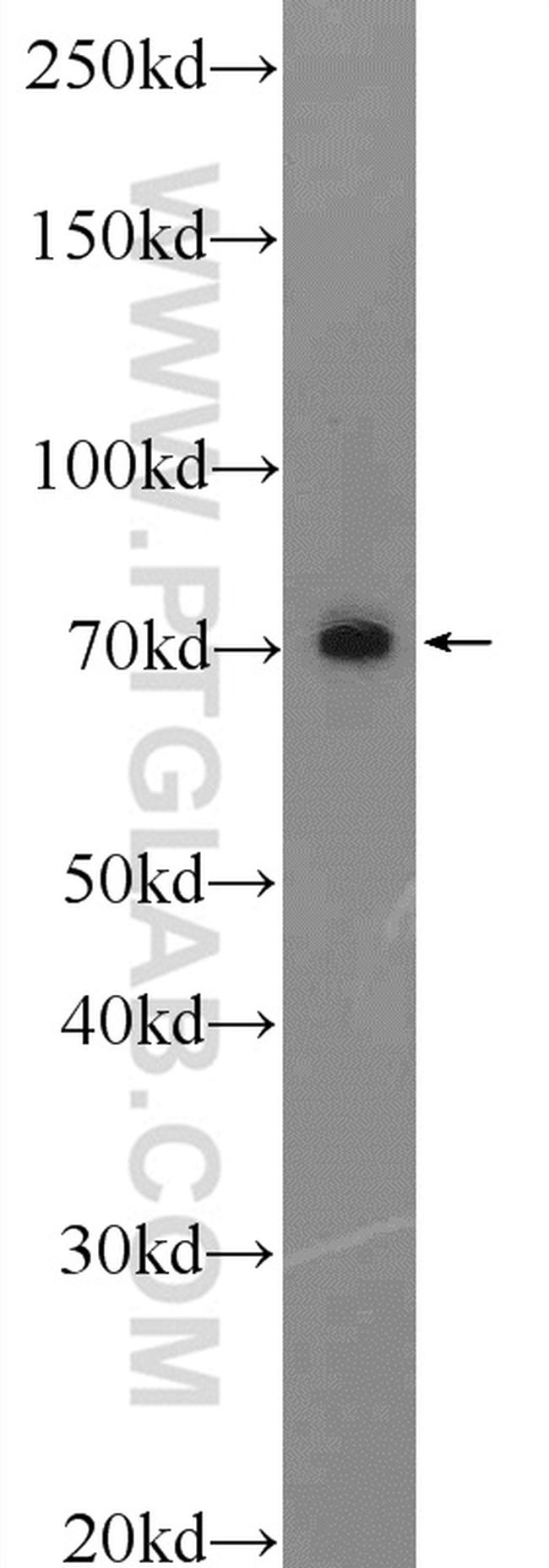 C17orf85 Antibody in Western Blot (WB)