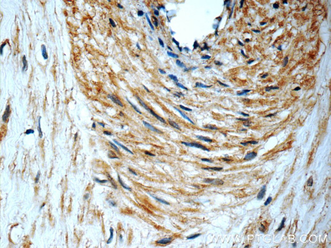 PERK/EIF2AK3 Antibody in Immunohistochemistry (Paraffin) (IHC (P))