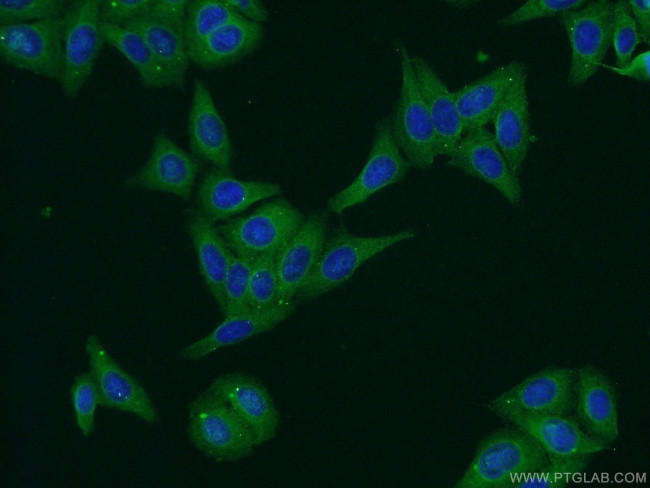 PERK/EIF2AK3 Antibody in Immunocytochemistry (ICC/IF)