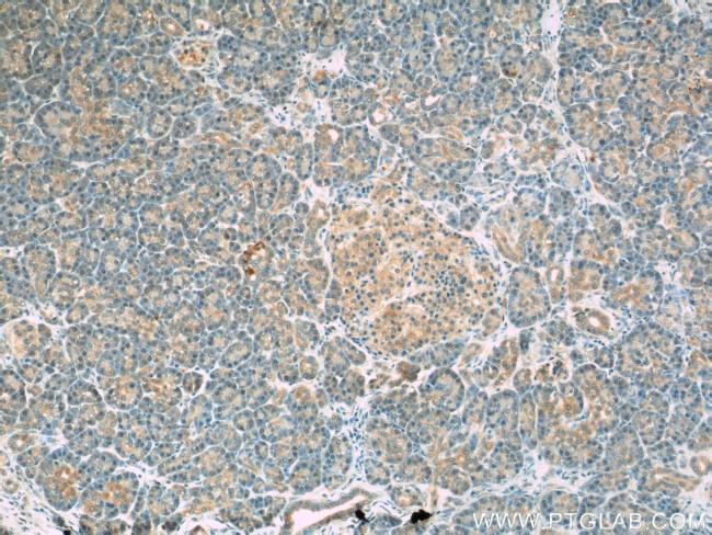 PERK/EIF2AK3 Antibody in Immunohistochemistry (Paraffin) (IHC (P))