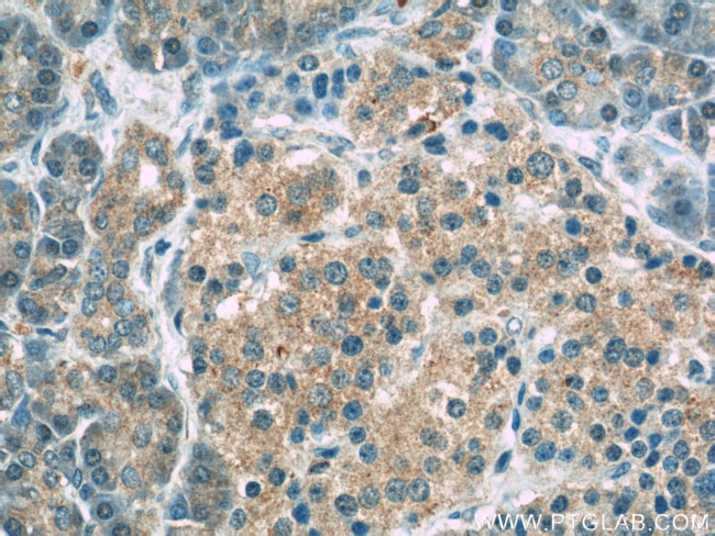 PERK/EIF2AK3 Antibody in Immunohistochemistry (Paraffin) (IHC (P))