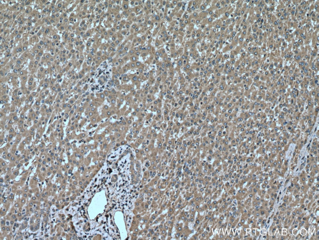 PERK/EIF2AK3 Antibody in Immunohistochemistry (Paraffin) (IHC (P))