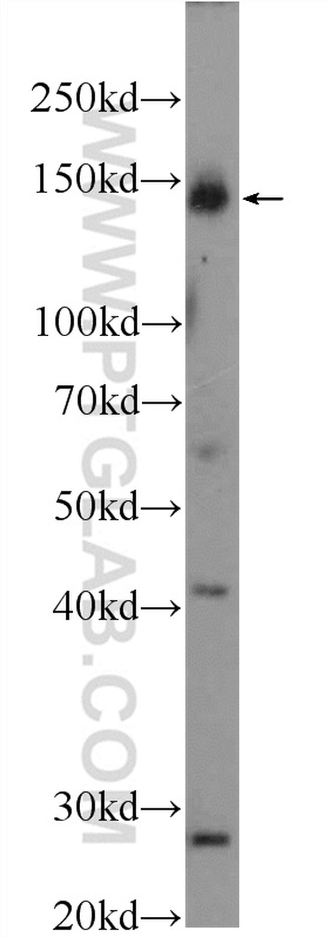 PERK/EIF2AK3 Antibody in Western Blot (WB)