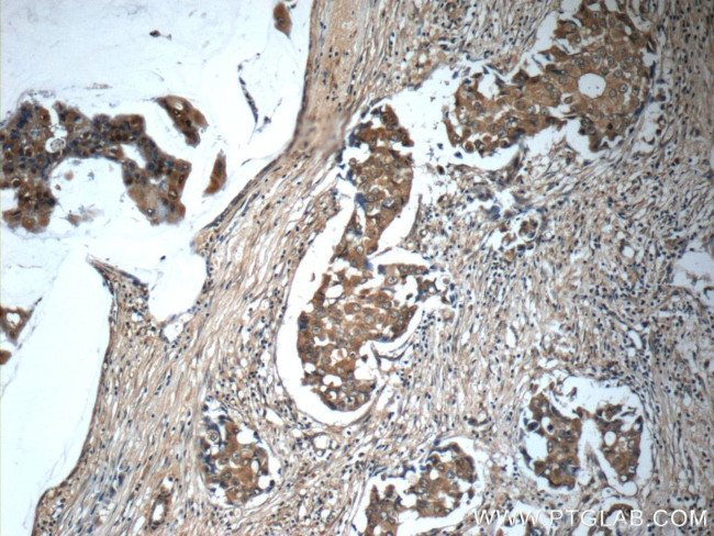 IL-19 Antibody in Immunohistochemistry (Paraffin) (IHC (P))