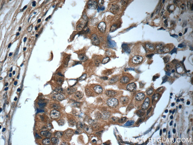 IL-19 Antibody in Immunohistochemistry (Paraffin) (IHC (P))