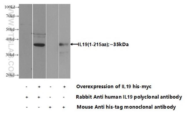 IL-19 Antibody in Western Blot (WB)