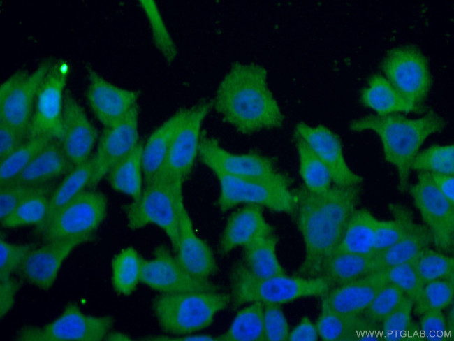 TRIM16 Antibody in Immunocytochemistry (ICC/IF)