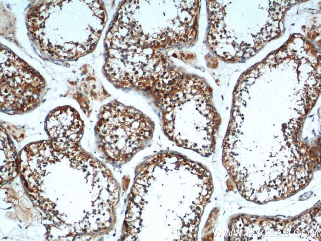 TRIM16 Antibody in Immunohistochemistry (Paraffin) (IHC (P))