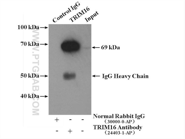 TRIM16 Antibody in Immunoprecipitation (IP)