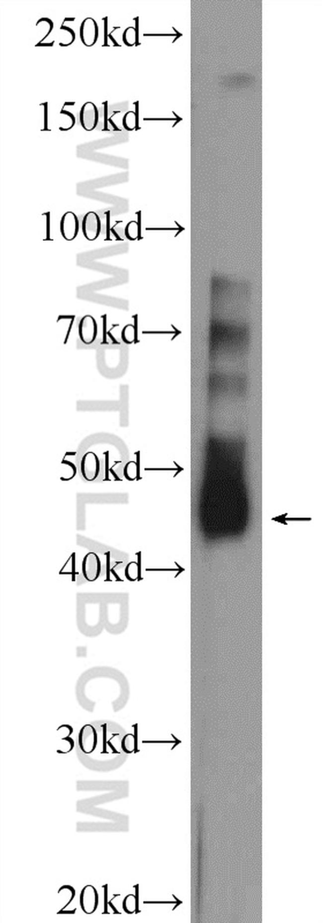 TFB2M Antibody in Western Blot (WB)