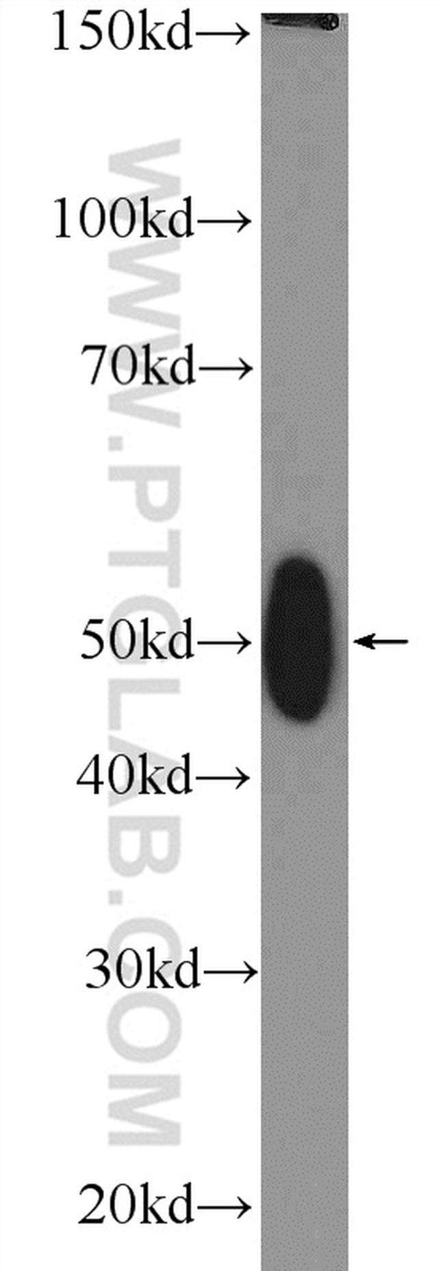 TFB2M Antibody in Western Blot (WB)