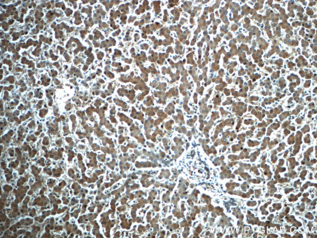 ATG14/Barkor (C-terminal) Antibody in Immunohistochemistry (Paraffin) (IHC (P))