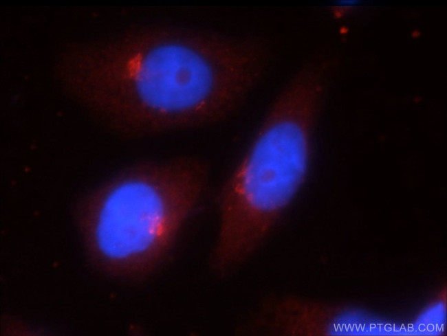 ATG14/Barkor (C-terminal) Antibody in Immunocytochemistry (ICC/IF)