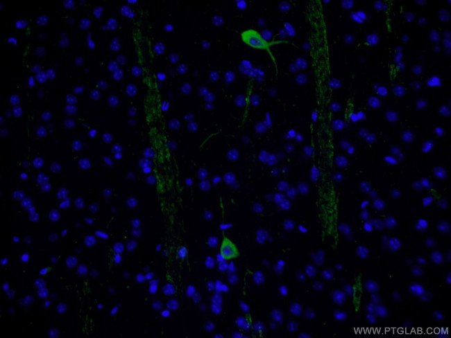 CHAT Antibody in Immunohistochemistry (PFA fixed) (IHC (PFA))