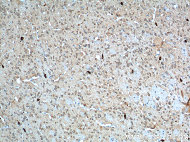 CHAT Antibody in Immunohistochemistry (Paraffin) (IHC (P))