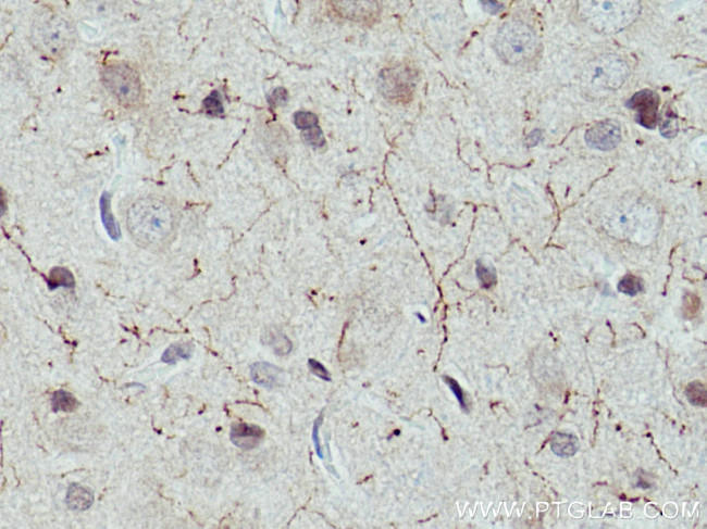 CHAT Antibody in Immunohistochemistry (Paraffin) (IHC (P))