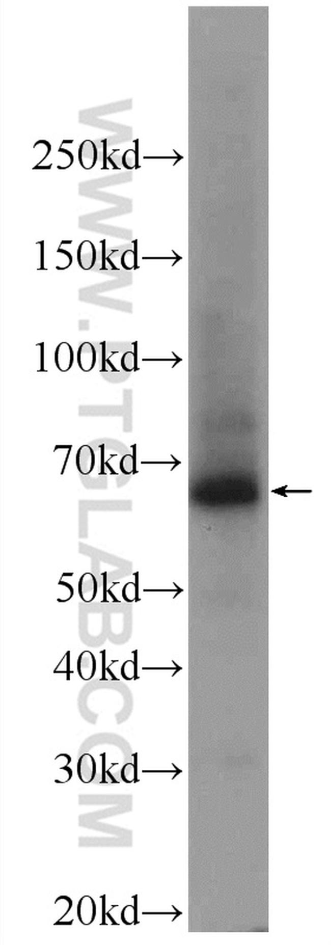 CHAT Antibody in Western Blot (WB)