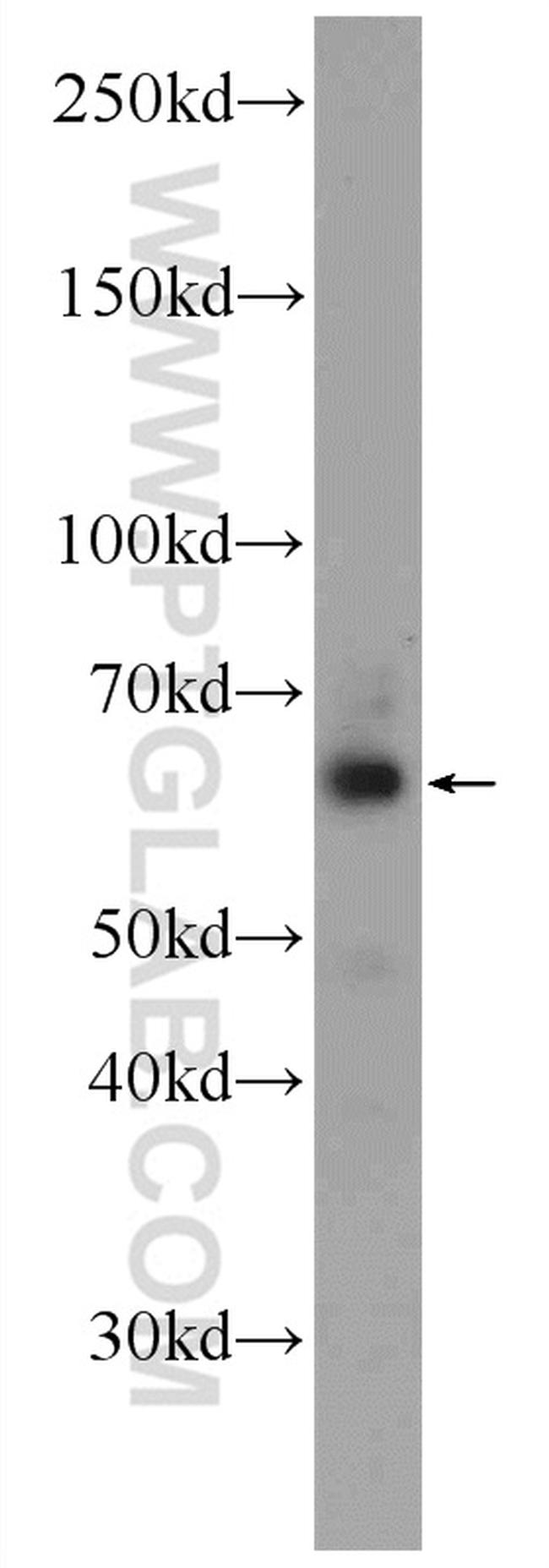 CHAT Antibody in Western Blot (WB)