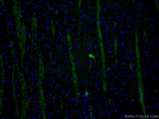 CHAT Antibody in Immunohistochemistry (PFA fixed) (IHC (PFA))