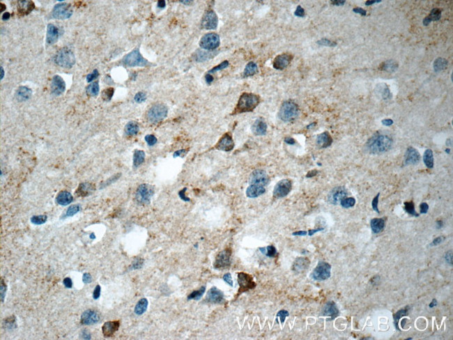 CHAT Antibody in Immunohistochemistry (Paraffin) (IHC (P))