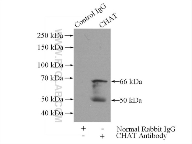 CHAT Antibody in Immunoprecipitation (IP)